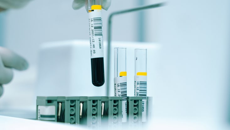 Reagenzglas mit Blut